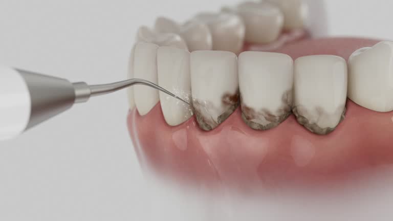 Reliable Dental Implants contractor in Eudora, KS by Smile Center Dentistry